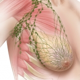 LYMPH NODES OF THE BREAST