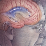 ADULT HYDROCEPHALUS