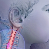 ASTROCYTOMA