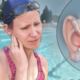 SWIMMER'S EAR