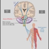 TRIAL EXHIBIT SHOWING MOTOR CORTEX FUNCTION